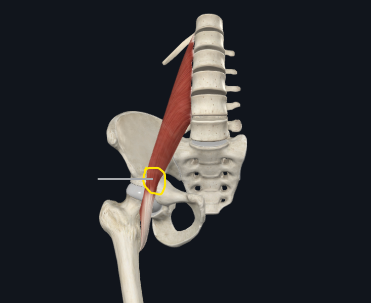 Acupuncture for PSOAS release Sydney