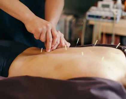 Acupuncture treatment on a portable table